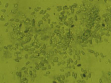 ��˷�֦�˾�