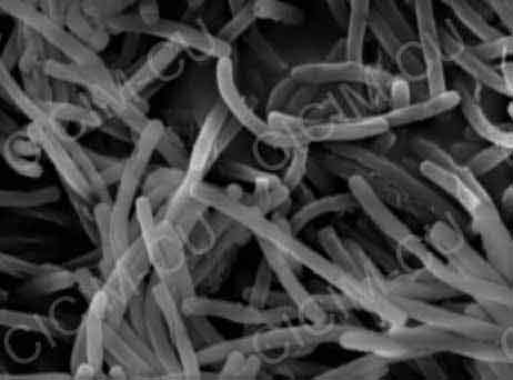 �׻��׸˾��¶�������