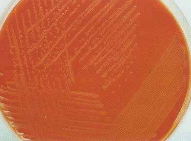 ��ͷ����