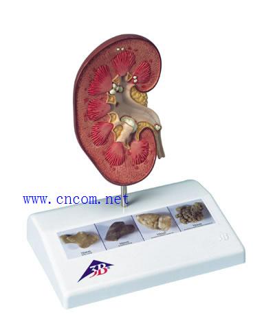 �¹�3B�������ģ��-����ʯģ�� �ͺ�:M323813