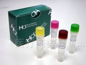 ���� ��Ѫ����Ƥϸ��ճ������1��VCAM-1/CD106��ELISA�Լ��� ���� �ֻ�13585655937