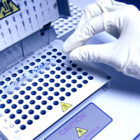 С��ø�����(IFN-��)ELISA�Լ���