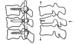 �ǿ�ƽ�Ѿ���