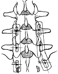 �ǿ����޽Ӵ��ְ�