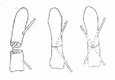 �ǿƿ����루׶�����У�