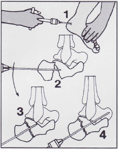 �ǿ�˹���루׶���У�