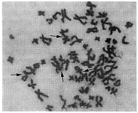 NCI-H520�˷ΰ�ϸ��