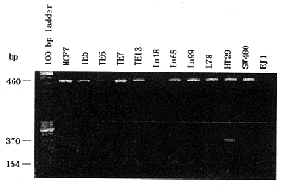 MDA-MB-231���ٰ�ϸ��