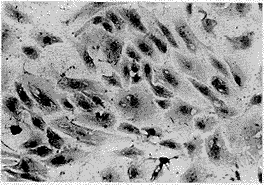 Beta-TC-6С�����ٰ�betaϸ��