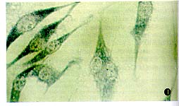 ����ĸϸ����ϸ��A172