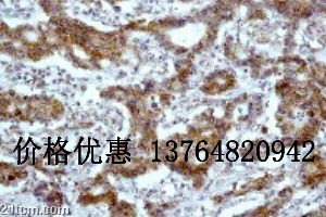 ת¼����E2F-1����Anti-E2F1