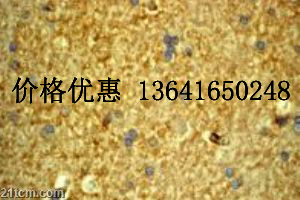 ��Ҫ��֯�����Ը�����I