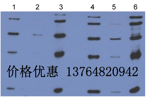 Anti-Nociceptin receptor�·�������ʹ�������忹��