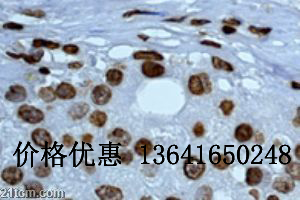 ӫ���ر��5-��ɫ�����忹��IgG Anti-5-HT2/FITC