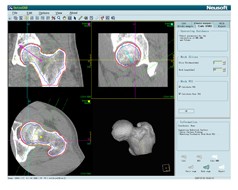 ���ܶȼ�����������ϵͳ