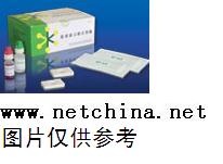 ø�������Լ�/������֬(ACA)����IgG/M/A 96T �ͺ�:WKHS-J036/���� ��ţ�M