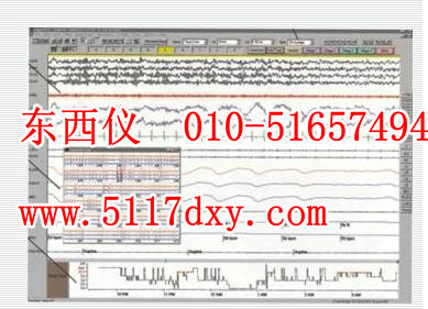 ˯���Ե����ϵͳ/�ർ˯�߷���ϵͳ������Ƶ��