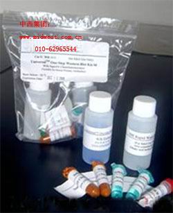 һ����ELISA�Լ���/ͨ��TMһ��ELISA�Լ���-